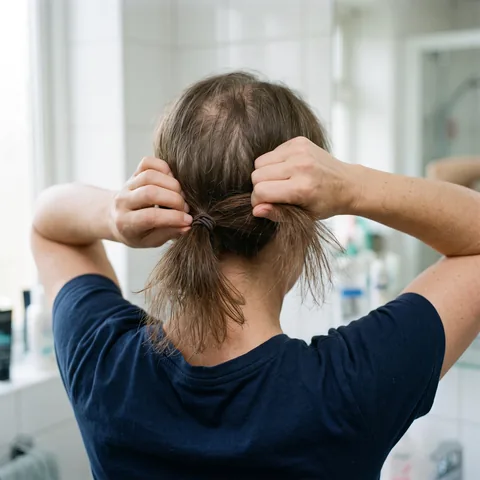 Cola de caballo delgada, pérdida de densidad en todo el cabello