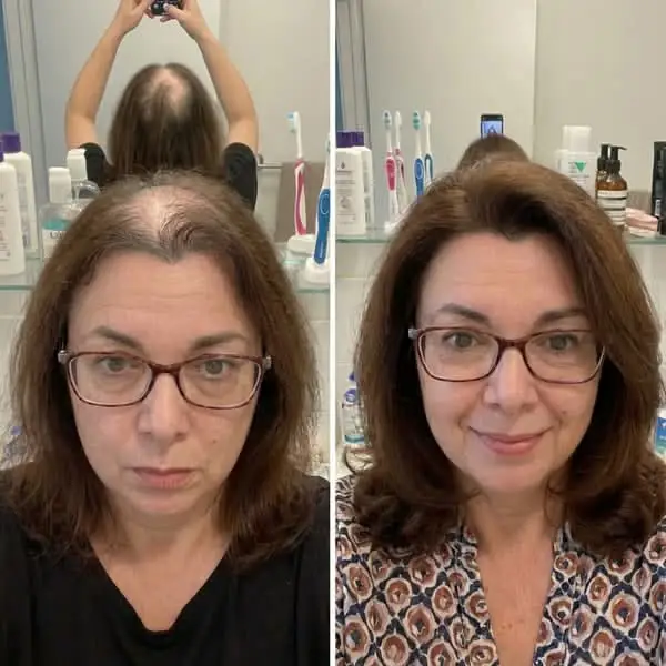 Antes y después del tratamiento capilar casero