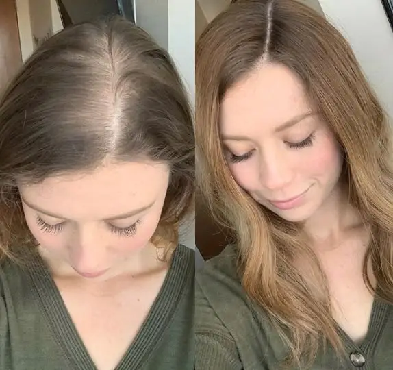 Antes y después del tratamiento capilar casero