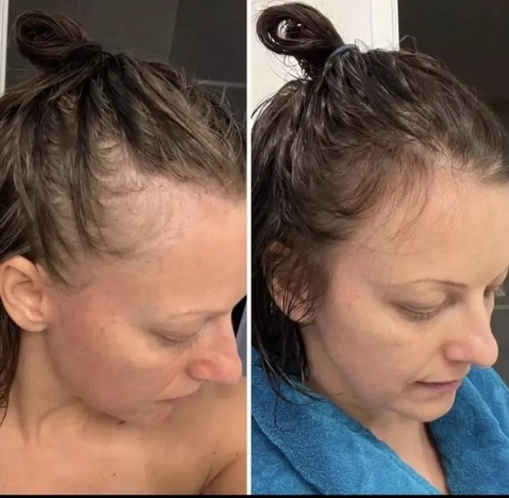 Antes y después del tratamiento capilar casero