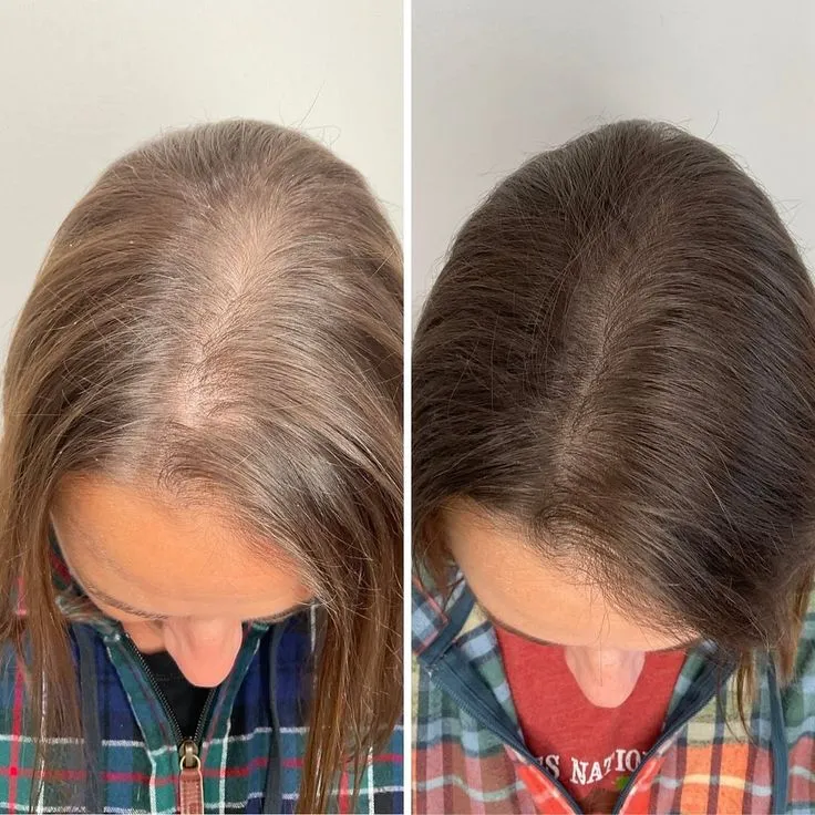 Antes y después del tratamiento capilar casero