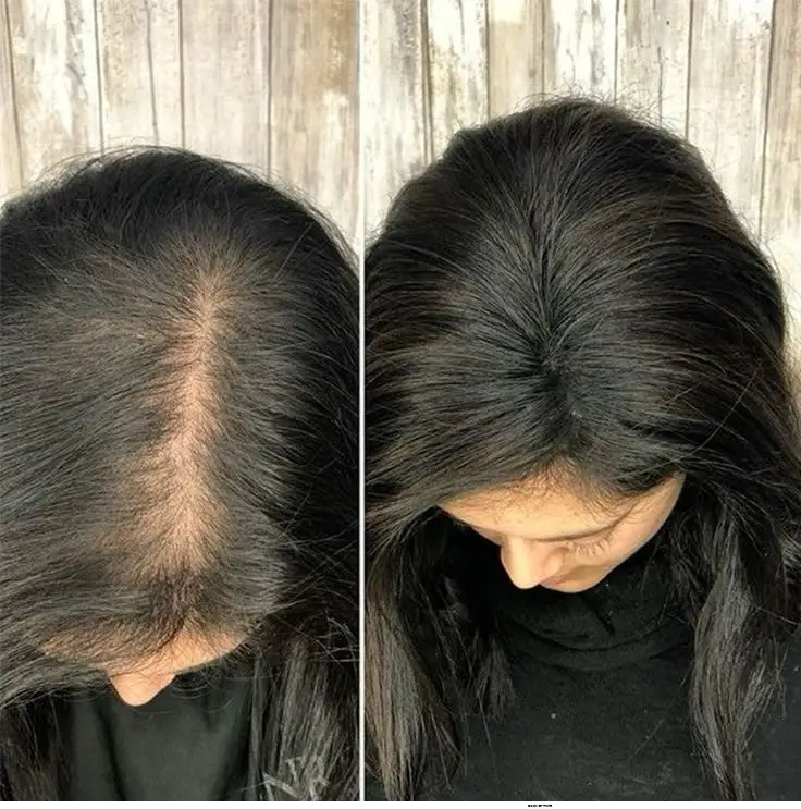 Antes y después del tratamiento capilar casero